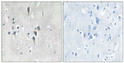 Immunohistochemistry analysis of paraffin-embedded human brain tissue using CaMK2 alpha/delta Antibody. The picture on STJ91988