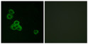 Immunofluorescence analysis of MCF7 cells using CaMK2 alpha/delta Antibody. The picture on the right is blocked with STJ91988