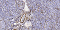 Immunohistochemical analysis of paraffin-embedded human tonsil. 1, Tris-EDTA, pH 9.0 was used for antigen retrieval. 2, STJ91999