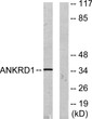 Western blot analysis of lysates from COLO205 cells, using ANKRD1 Antibody. The lane on the right was blocked with the STJ92005