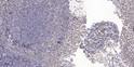 Immunohistochemical analysis of paraffin-embedded human tonsil. 1, Antibody was diluted at 1:200 (4°C overnight). 2, STJ92005