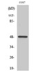 Western Blot analysis of various cells using Casein Kinase Iγ1 Polyclonal Antibody STJ92012