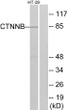 Western blot analysis of lysates from HT-29 cells, treated with Forskolin, using Catenin-beta Antibody. The lane on the right is blocked with the synthesized peptide.