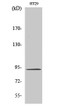 Western blot analysis of HT29 cells using Catenin-Beta Polyclonal Antibody diluted at 1：1000