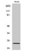 Western blot analysis of HuvEc cells using Caveolin-1 Polyclonal Antibody diluted at 1：1000