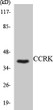 Western blot analysis of the lysates from RAW264.7 cells using CCRK antibody. STJ92076
