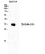 Western blot analysis of SH-SY5Y cells using CD32 polyclonal antibody diluted at 1:1000 STJ92119