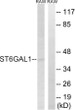 Western blot analysis of lysates from RAW264.7 cells, using ST6GAL1 Antibody. The lane on the right is blocked with the synthesized peptide.