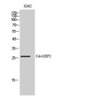Western blot analysis of K562 cells using Cdc42EP2 polyclonal antibody STJ92173