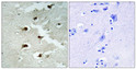 Immunohistochemistry analysis of paraffin-embedded human brain tissue, using CDCA4 Antibody. The picture on the right is blocked with the synthesized peptide.