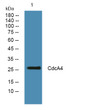 Western blot analysis of lysates from A431 cells, primary antibody was diluted at 1:1000, 4°C over night