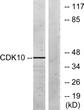 Western blot analysis of lysates from 293 cells, using CDK10 Antibody. The lane on the right is blocked with the STJ92195