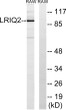 Western blot analysis of lysates from RAW264.7 cells, using CEP97 Antibody. The lane on the right was blocked with the STJ92232