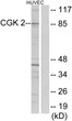 Western blot analysis of lysates from HUVEC cells, using CGK 2 Antibody. The lane on the right is blocked with the synthesized peptide.