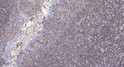Immunohistochemical analysis of paraffin-embedded human tonsil. 1, Antibody was diluted at 1:200 (4° overnight). 2, STJ92257