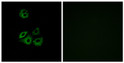 Immunofluorescence analysis of A549 cells, using CCBP2 Antibody. The picture on the right is blocked with the synthesized peptide.