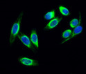 Immunofluorescence analysis of Hela cell. 1, c-Kit Polyclonal Antibody (green) was diluted at 1:200 (4°C overnight). 2, Goat Anti Rabbit Alexa Fluor 488 Catalog: (NA was diluted at 1:1000 (room temperature, 50min). 3 DAPI (blue) 10min. Immunofluorescence analysis of Hela cell. 1, c-Kit Polyclonal Antibody (green) was diluted at 1:200 (4°C overnight). 2, Goat Anti Rabbit Alexa Fluor 488 Catalog: (NA was diluted at 1:1000 (room temperature, 50min). 3 DAPI (blue) 10min.