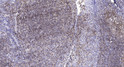 Immunohistochemical analysis of paraffin-embedded human tonsil. 1, Antibody was diluted at 1:200 (4° overnight). 2, STJ92309