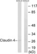 Western blot analysis of lysates from COLO cells, using Claudin 4 Antibody. The lane on the right is blocked with the synthesized peptide.