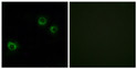 Immunofluorescence analysis of HUVEC cells, using CLDN6 Antibody. The picture on the right is blocked with the synthesized peptide. Immunofluorescence analysis of HUVEC cells, using CLDN6 Antibody. The picture on the right is blocked with the synthesized peptide.