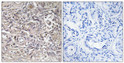 Immunohistochemistry analysis of paraffin-embedded human ovary tissue, using CLDN6 Antibody. The picture on the right is blocked with the synthesized peptide. Immunohistochemistry analysis of paraffin-embedded human ovary tissue, using CLDN6 Antibody. The picture on the right is blocked with the synthesized peptide.