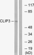 Western blot analysis of lysates from A549 cells, using CLIP3 Antibody. The lane on the right is blocked with the synthesized peptide.