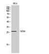 Western Blot analysis of HeLa cells using CMTM4 Polyclonal Antibody STJ92351