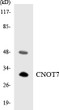 Western blot analysis of the lysates from HUVEC cells using CNOT7 antibody. STJ92367