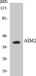 Western blot analysis of the lysates from HeLa cells using AIM2 antibody.