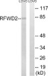 Western blot analysis of lysates from LOVO cells, using RFWD2 Antibody. The lane on the right is blocked with the synthesized peptide.