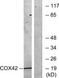 Western blot analysis of lysates from K562 cells treated with insulin 0.01U/ml for 15', using COX42 Antibody. The lane STJ92440