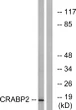 Western blot analysis of lysates from HT-29 cells, using CRABP2 Antibody. The lane on the right is blocked with the STJ92459