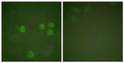 Immunofluorescence analysis of HeLa cells, using Cyclin B1 Antibody. The picture on the right is blocked with the synthesized peptide.