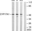Western blot analysis of lysates from Jurkat, A549, and HeLa cells, using Cytochrome P450 17A1 Antibody. The lane on STJ92554