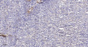 Immunohistochemical analysis of paraffin-embedded human spleen. 1, Antibody was diluted at 1:200 (4° overnight). 2, STJ92591