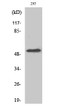 Western blot analysis of HeLa cells using CYP39A1 Polyclonal Antibody STJ92592