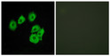 Immunofluorescence analysis of HUVEC cells using CLTR1 Antibody. The picture on the right is blocked with the STJ92609