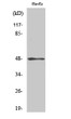 Western blot analysis of various cells using Cytokeratin 17 Polyclonal Antibody diluted at 1：2000