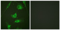 Immunofluorescence analysis of HeLa cells, using Keratin 8 Antibody. The picture on the right is blocked with the synthesized peptide.