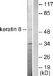 Western blot analysis of lysates from SKOV3 cells, using Keratin 8 Antibody. The lane on the right is blocked with the synthesized peptide.