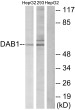 Western blot analysis of lysates from HepG2 and 293 cells, using Dab1 Antibody. The lane on the right is blocked with the synthesized peptide.