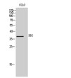 Western Blot analysis of COLO cells using DD2 Polyclonal Antibody STJ92670