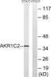 Western blot analysis of lysates from COLO cells, using AKR1C2 Antibody. The lane on the right is blocked with the STJ92670
