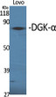 Western Blot analysis of various cells using DGK-α Polyclonal Antibody STJ92696