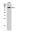 Western blot analysis of Lovo cells using DGK-α polyclonal antibody. STJ92696