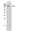 Western blot analysis of HT-29 cells using DGK-θ polyclonal antibody STJ92702