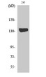 Western blot analysis of various cells using DGK-ι Polyclonal Antibody diluted at 1:1000 STJ92703