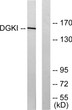 Western blot analysis of lysates from 293 cells, using DGKI Antibody. The lane on the right is blocked with the STJ92703