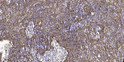 Immunohistochemical analysis of paraffin-embedded human spleen tissue. 1, Primary antibody was diluted at 1:200 (4° STJ92703