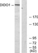 Western blot analysis of lysates from 293 cells, using DIDO1 Antibody. The lane on the right was blocked with the STJ92716